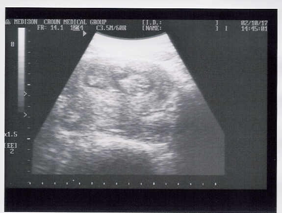 Ultrasound 10/17/02, 12 Weeks
Yes that is a baby!!!!